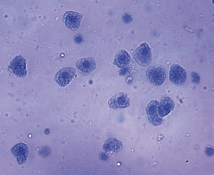 Клетки печени (гепатоциты)